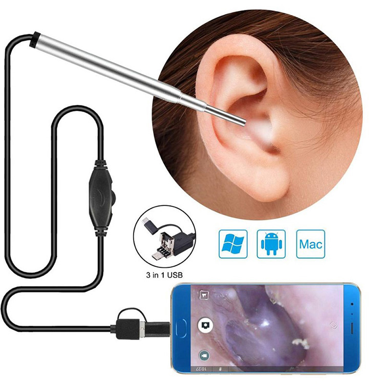 Medical Endoscope Camerae Nasi Endoscope Usb Otoscope